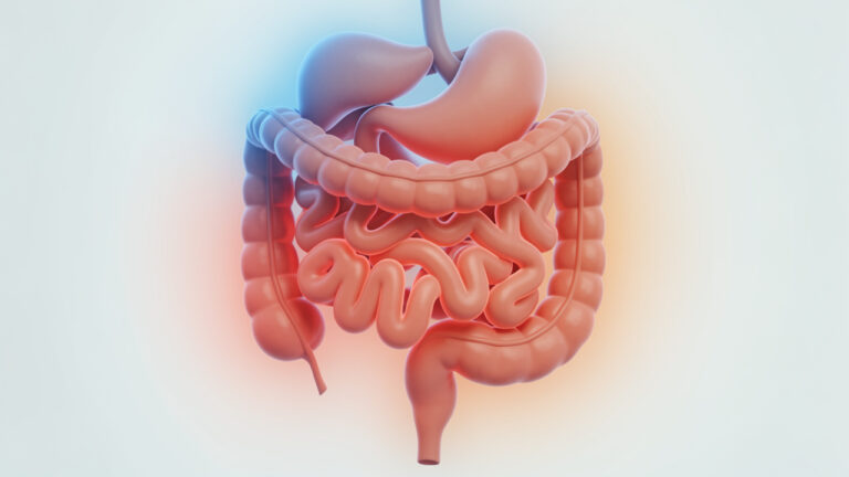 Illustration médicale non graphique montrant le bas du système digestif avec une zone rouge symbolisant l’irritation et des couleurs évoquant le stress.